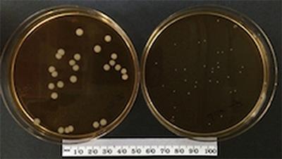 Reduced Innate Immune Response to a Staphylococcus aureus Small Colony Variant Compared to Its Wild-Type Parent Strain